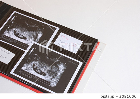 エコー写真 写真 アルバム 胎児の写真素材