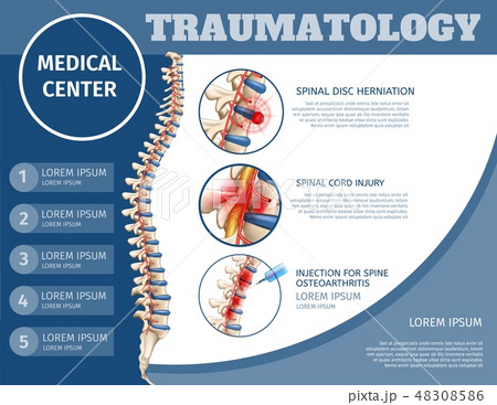 脊髄損傷のイラスト素材