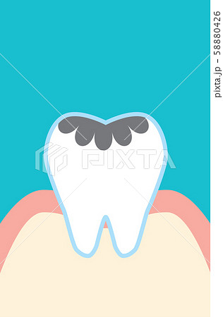 歯茎のイラスト素材