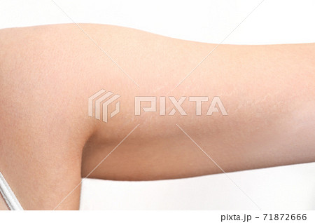 肌割れの写真素材
