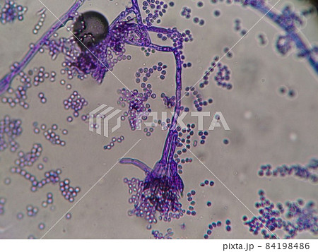 アスペルギルス分生子柄の図